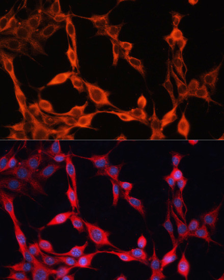 SLC25A23 Antibody in Immunocytochemistry (ICC/IF)