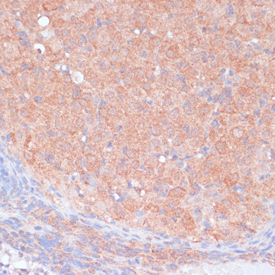 LRP1 Antibody in Immunohistochemistry (Paraffin) (IHC (P))