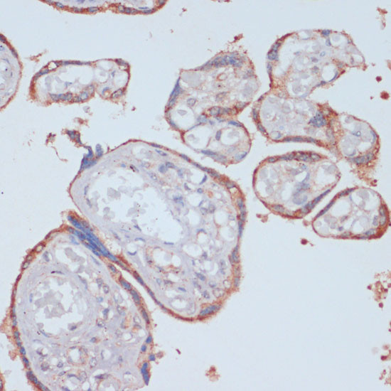 LRP1 Antibody in Immunohistochemistry (Paraffin) (IHC (P))