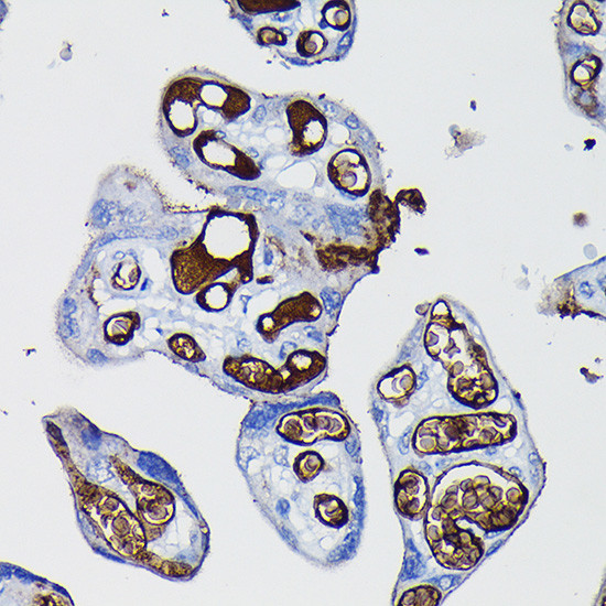 Fibrinogen alpha chain Antibody in Immunohistochemistry (Paraffin) (IHC (P))