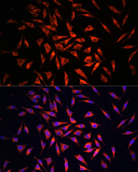 GSDMC Antibody in Immunocytochemistry (ICC/IF)