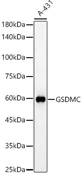 GSDMC Antibody in Western Blot (WB)