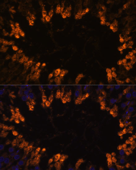 OXCT2 Antibody in Immunohistochemistry (Paraffin) (IHC (P))