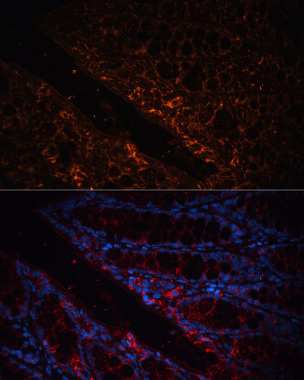 A33 Antibody in Immunohistochemistry (Paraffin) (IHC (P))