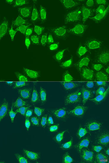 L2HGDH Antibody in Immunocytochemistry (ICC/IF)