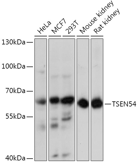 TSEN54 Antibody in Western Blot (WB)