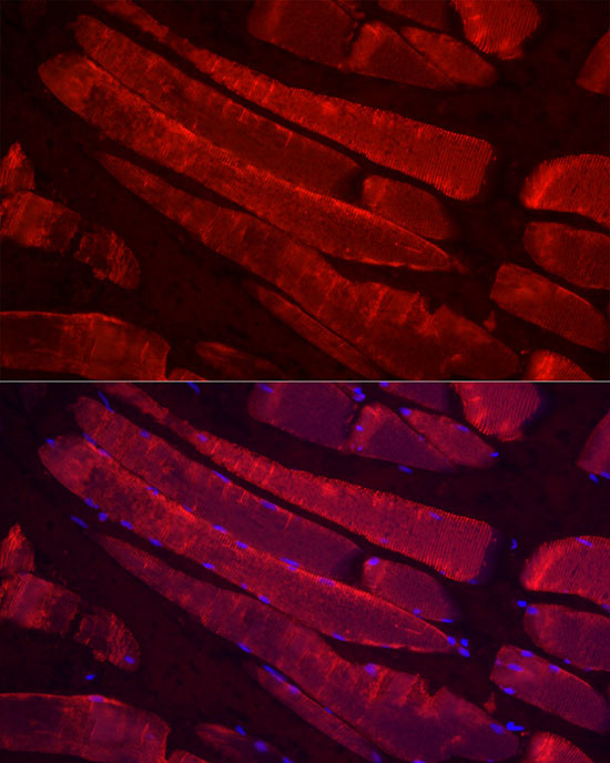 Myosin 4 Antibody in Immunocytochemistry (ICC/IF)