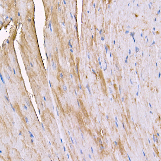 Myosin 4 Antibody in Immunohistochemistry (Paraffin) (IHC (P))