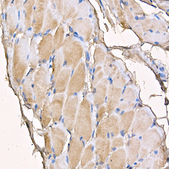 Myosin 4 Antibody in Immunohistochemistry (Paraffin) (IHC (P))