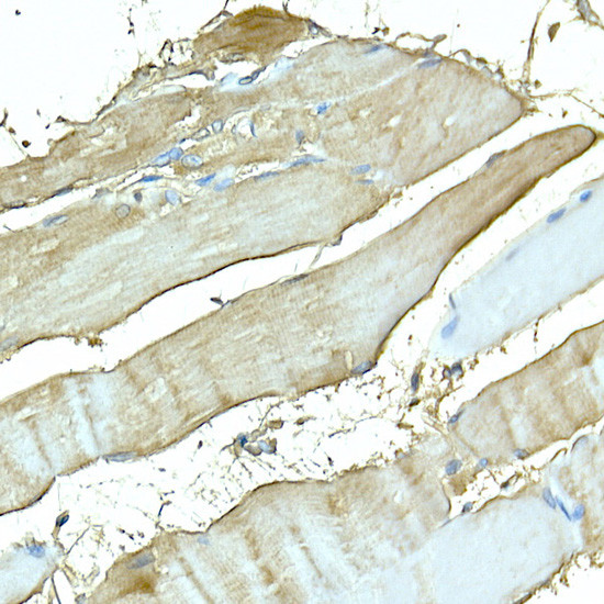 Myosin 4 Antibody in Immunohistochemistry (Paraffin) (IHC (P))