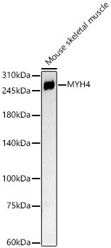 Myosin 4 Antibody in Western Blot (WB)