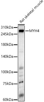 Myosin 4 Antibody in Western Blot (WB)