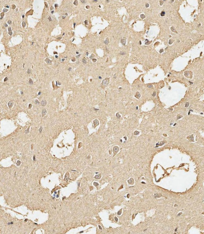 Calmodulin Antibody in Immunohistochemistry (Paraffin) (IHC (P))