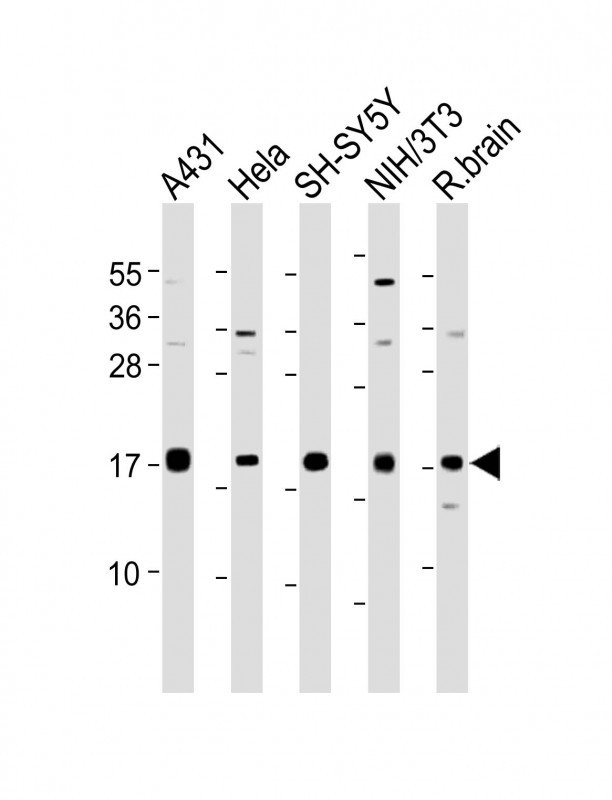 Calmodulin Antibody in Western Blot (WB)