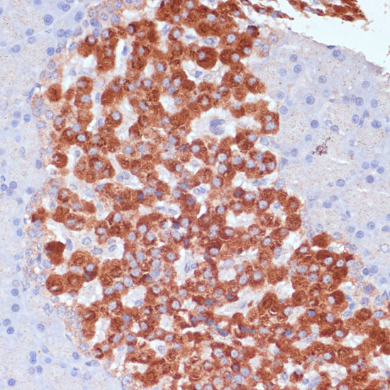 KANK2 Antibody in Immunohistochemistry (Paraffin) (IHC (P))