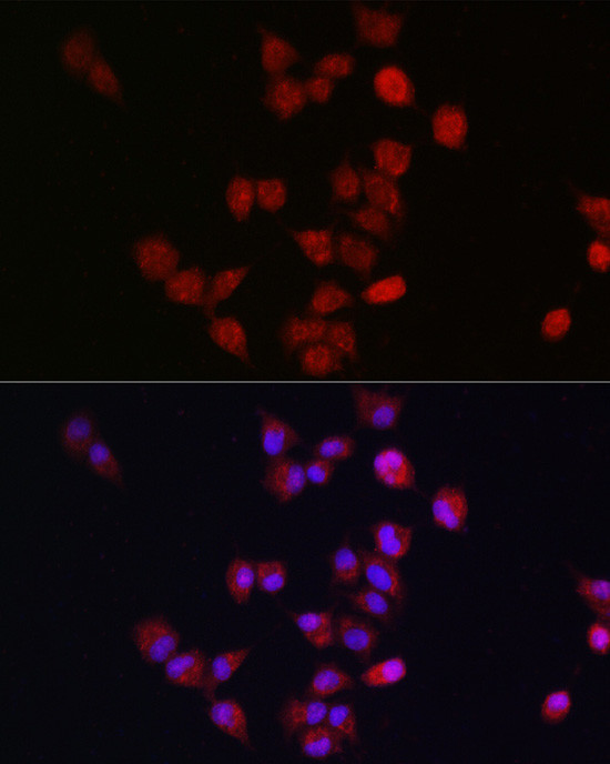 APC11 Antibody in Immunocytochemistry (ICC/IF)