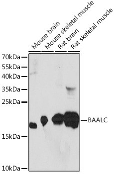 BAALC Antibody in Western Blot (WB)