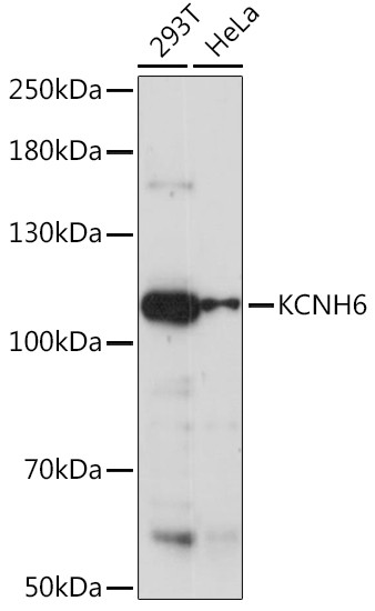 KCNH6 Antibody in Western Blot (WB)