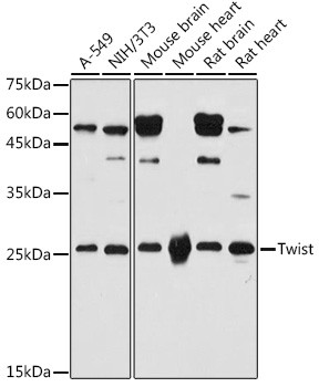 TWIST1 Antibody in Western Blot (WB)