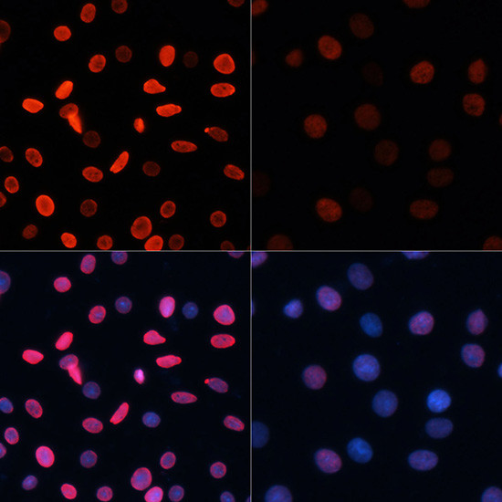 H2BK5ac Antibody in Immunocytochemistry (ICC/IF)