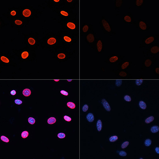 H2BK5ac Antibody in Immunocytochemistry (ICC/IF)