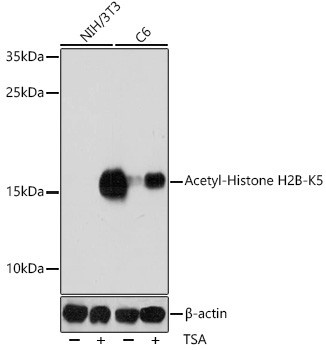 H2BK5ac Antibody in Western Blot (WB)