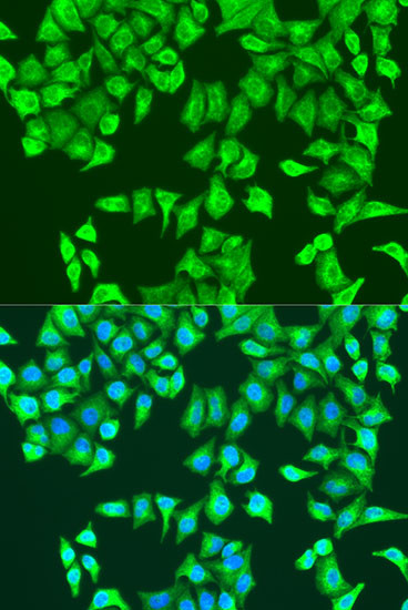 RhoA Antibody in Immunocytochemistry (ICC/IF)