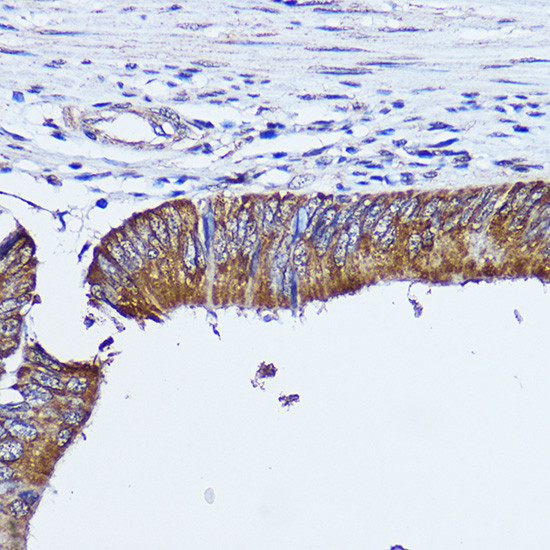 RhoA Antibody in Immunohistochemistry (Paraffin) (IHC (P))