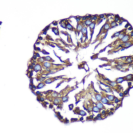 ACTR1B Antibody in Immunohistochemistry (Paraffin) (IHC (P))