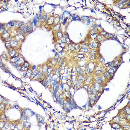 ACTR1B Antibody in Immunohistochemistry (Paraffin) (IHC (P))