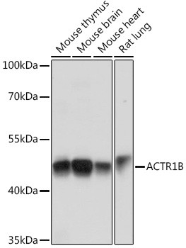 ACTR1B Antibody in Western Blot (WB)