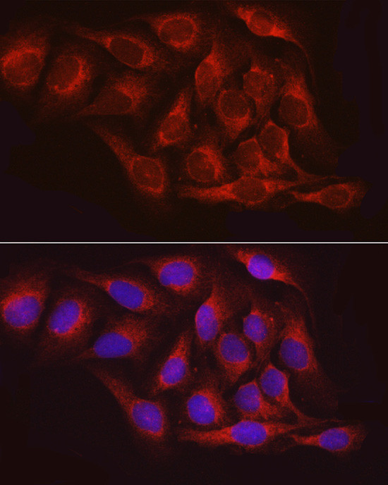 PTP1B Antibody in Immunocytochemistry (ICC/IF)