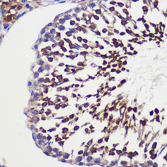 GCP6 Antibody in Immunohistochemistry (Paraffin) (IHC (P))