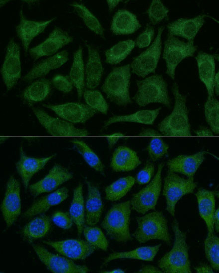 RAPGEF1 Antibody in Immunocytochemistry (ICC/IF)