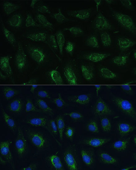 RAPGEF1 Antibody in Immunocytochemistry (ICC/IF)