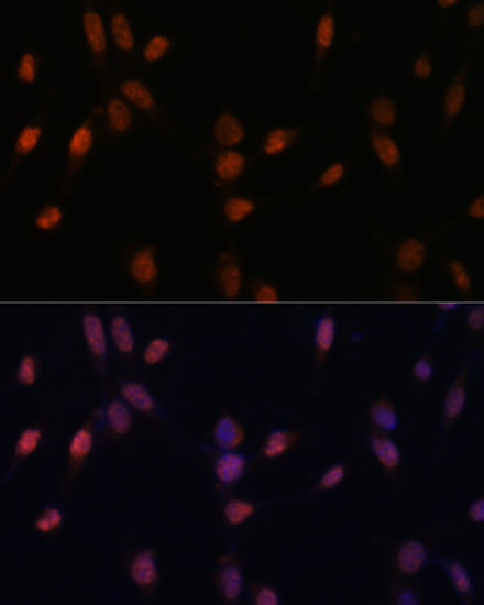 USP33 Antibody in Immunocytochemistry (ICC/IF)