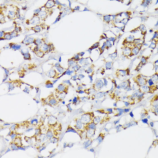 USP33 Antibody in Immunohistochemistry (Paraffin) (IHC (P))