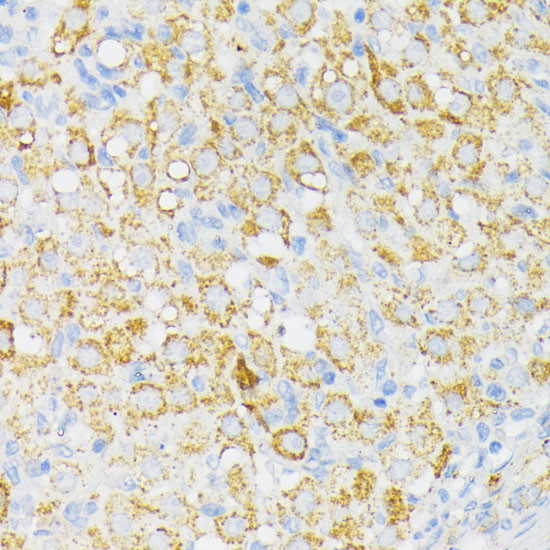 USP33 Antibody in Immunohistochemistry (Paraffin) (IHC (P))