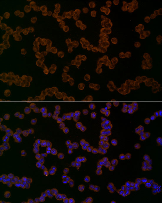 NALP1 Antibody in Immunocytochemistry (ICC/IF)