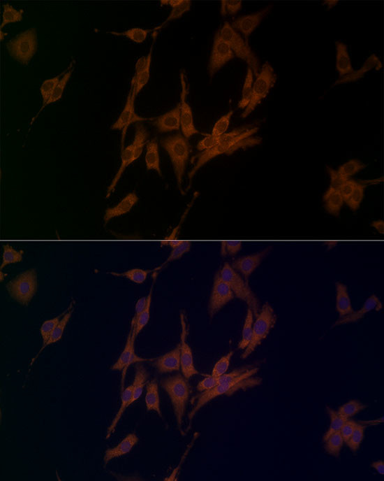 NALP1 Antibody in Immunocytochemistry (ICC/IF)