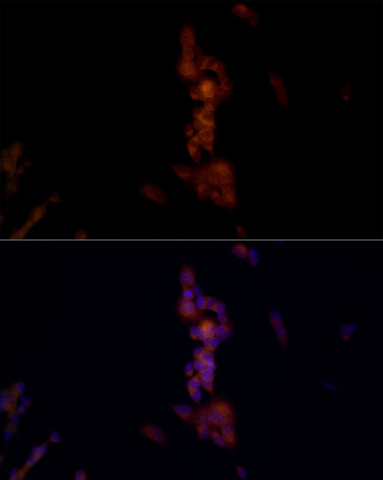 NALP1 Antibody in Immunocytochemistry (ICC/IF)