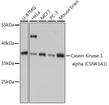 CK1 alpha Antibody in Western Blot (WB)