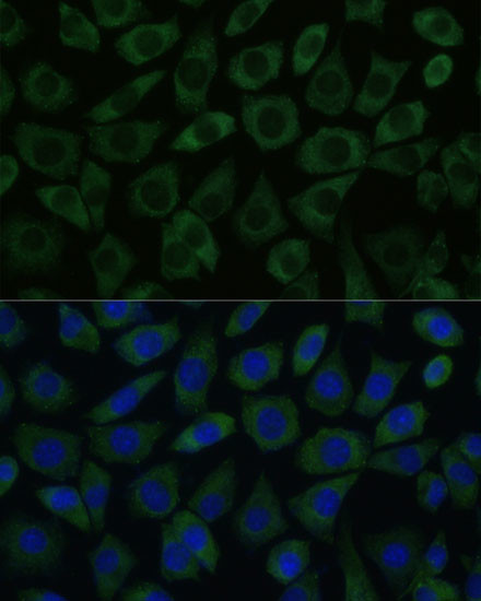 DDX6 Antibody in Immunocytochemistry (ICC/IF)