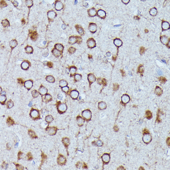 DDX6 Antibody in Immunohistochemistry (Paraffin) (IHC (P))