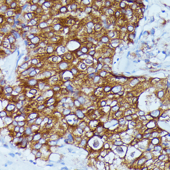 DDX6 Antibody in Immunohistochemistry (Paraffin) (IHC (P))