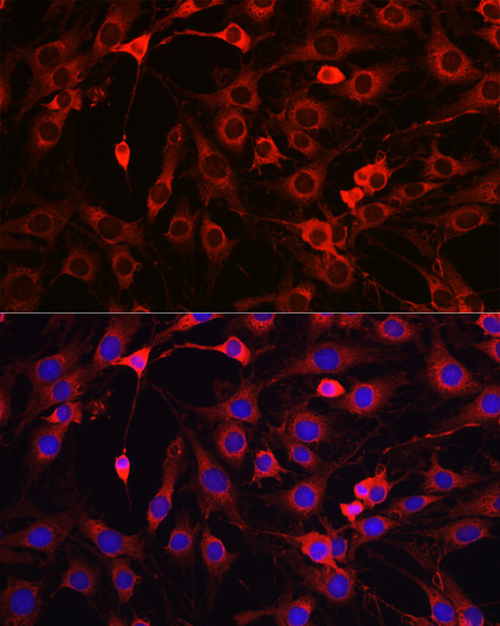 HMGCR Antibody in Immunocytochemistry (ICC/IF)