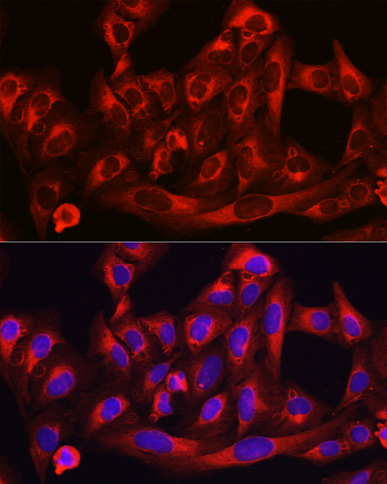 HMGCR Antibody in Immunocytochemistry (ICC/IF)