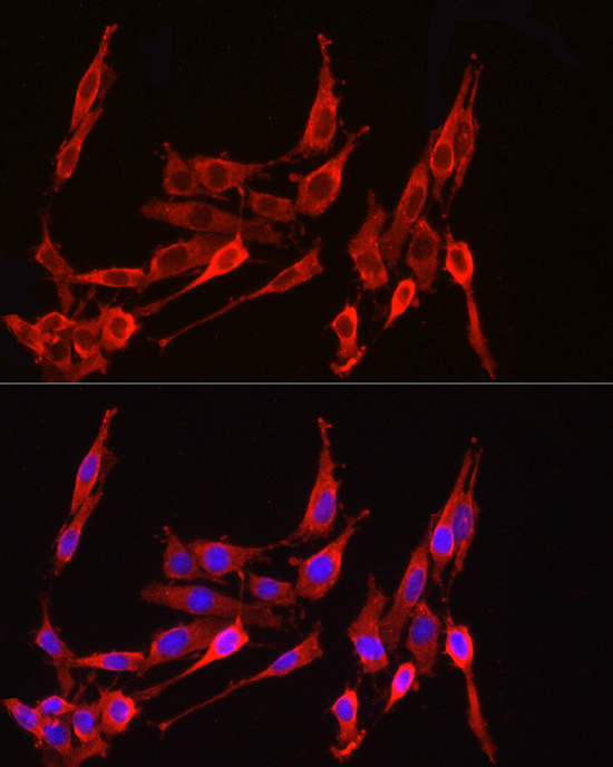 HMGCR Antibody in Immunocytochemistry (ICC/IF)