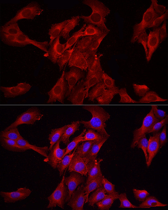 HMGCR Antibody in Immunocytochemistry (ICC/IF)