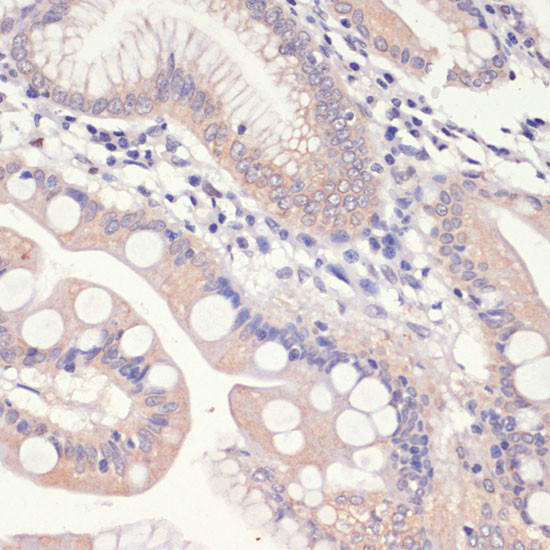 HMGCR Antibody in Immunohistochemistry (Paraffin) (IHC (P))